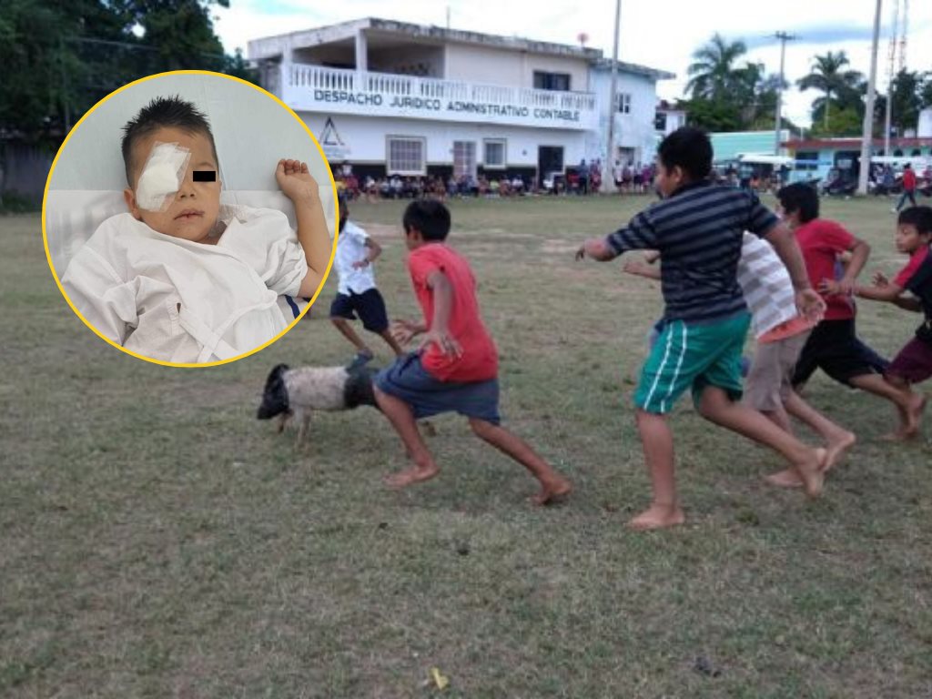 Padres de niño herido con cohete, organizan evento benéfico en Las Choapas para cubrir gastos médicos