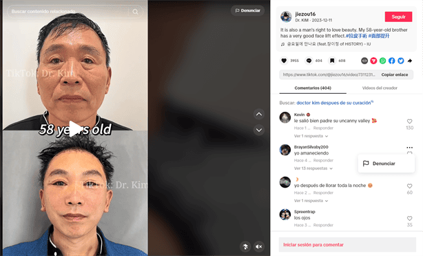 ¿Quién es el Dr. Kim, cirujano plástico que causó terror en TikTok?