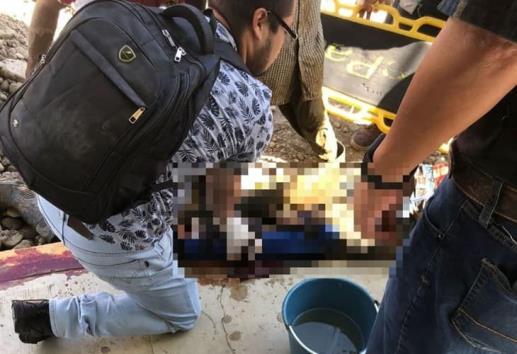 Trabajador resulta lesionado en Misantla