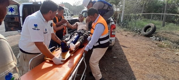 Albañil sufre graves lesiones en su pie al caerle una maquinaria en Paso de Ovejas