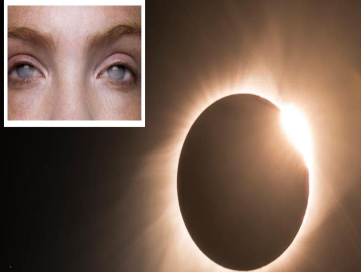 Esto le pasará a tu vista si intentas ver el eclipse de sol directamente