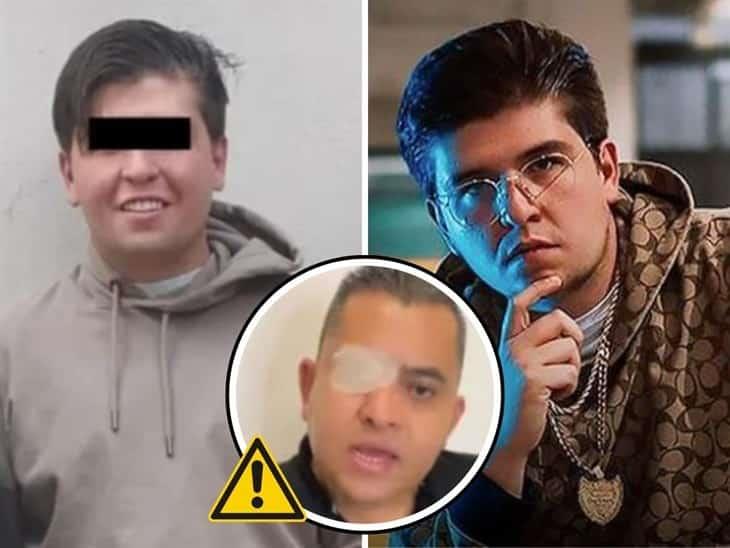 Fofo Márquez: escolta acusa al influencer por perder un ojo tras golpiza, esto sabemos 