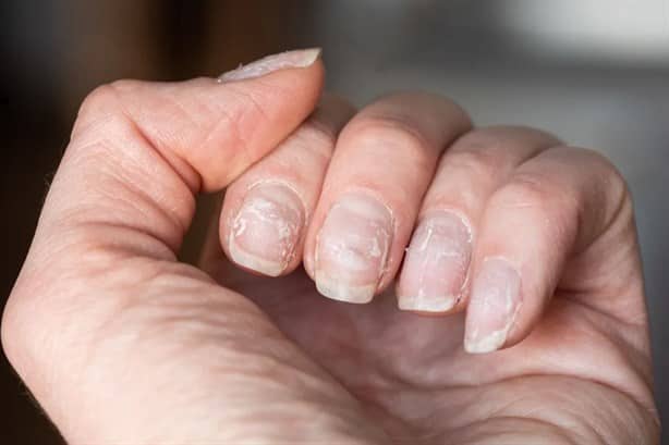 Uñas acrílicas: ¿Hay riesgos de usarlas con frecuencia? 