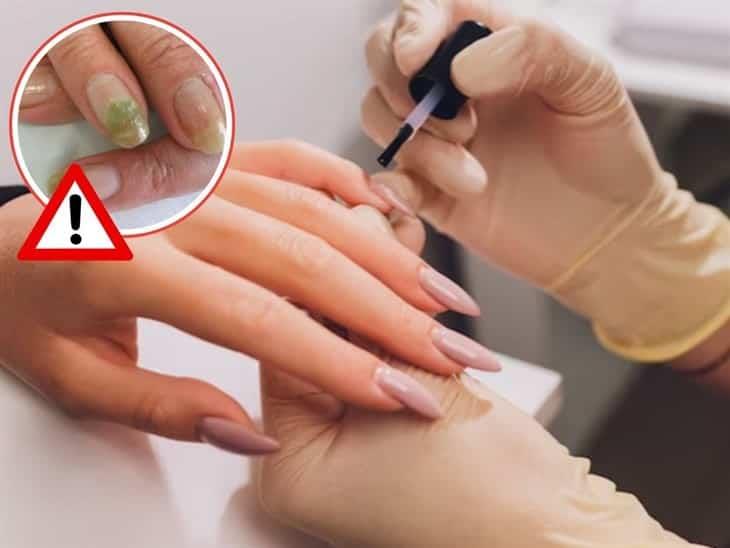 Uñas acrílicas: ¿Hay riesgos de usarlas con frecuencia? 