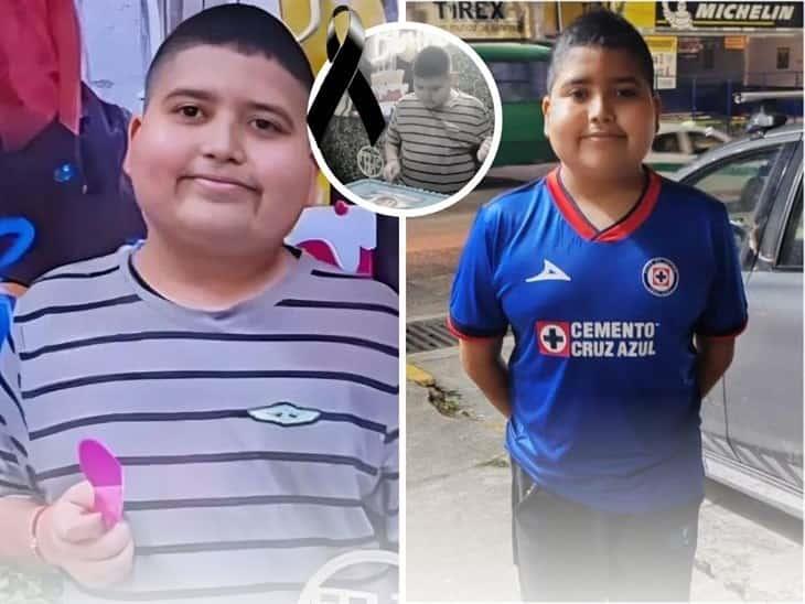 Muere José Armando, niño xalapeño con cáncer; así luchó en su vida