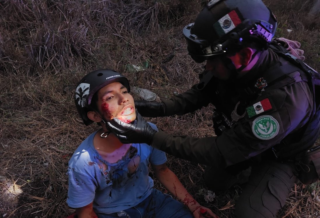 Joven herido tras accidente de bicicleta en autopista Veracruz-Cardel