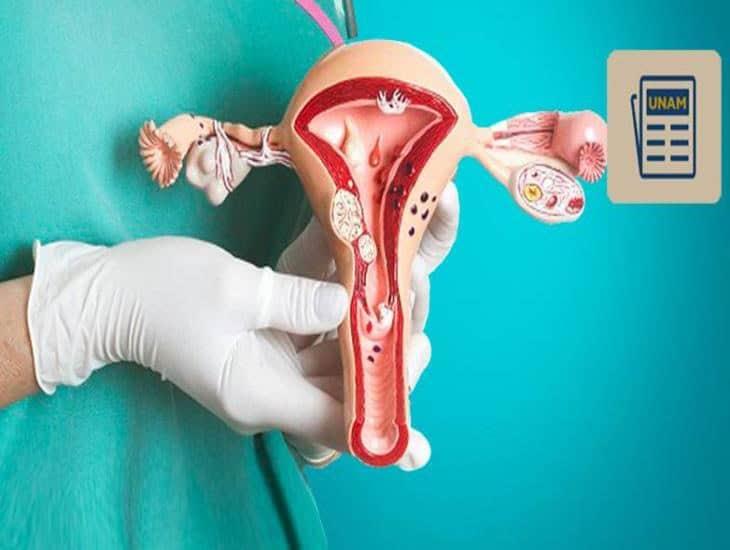 Si se detecta a tiempo el cáncer de ovario puede curarse totalmente