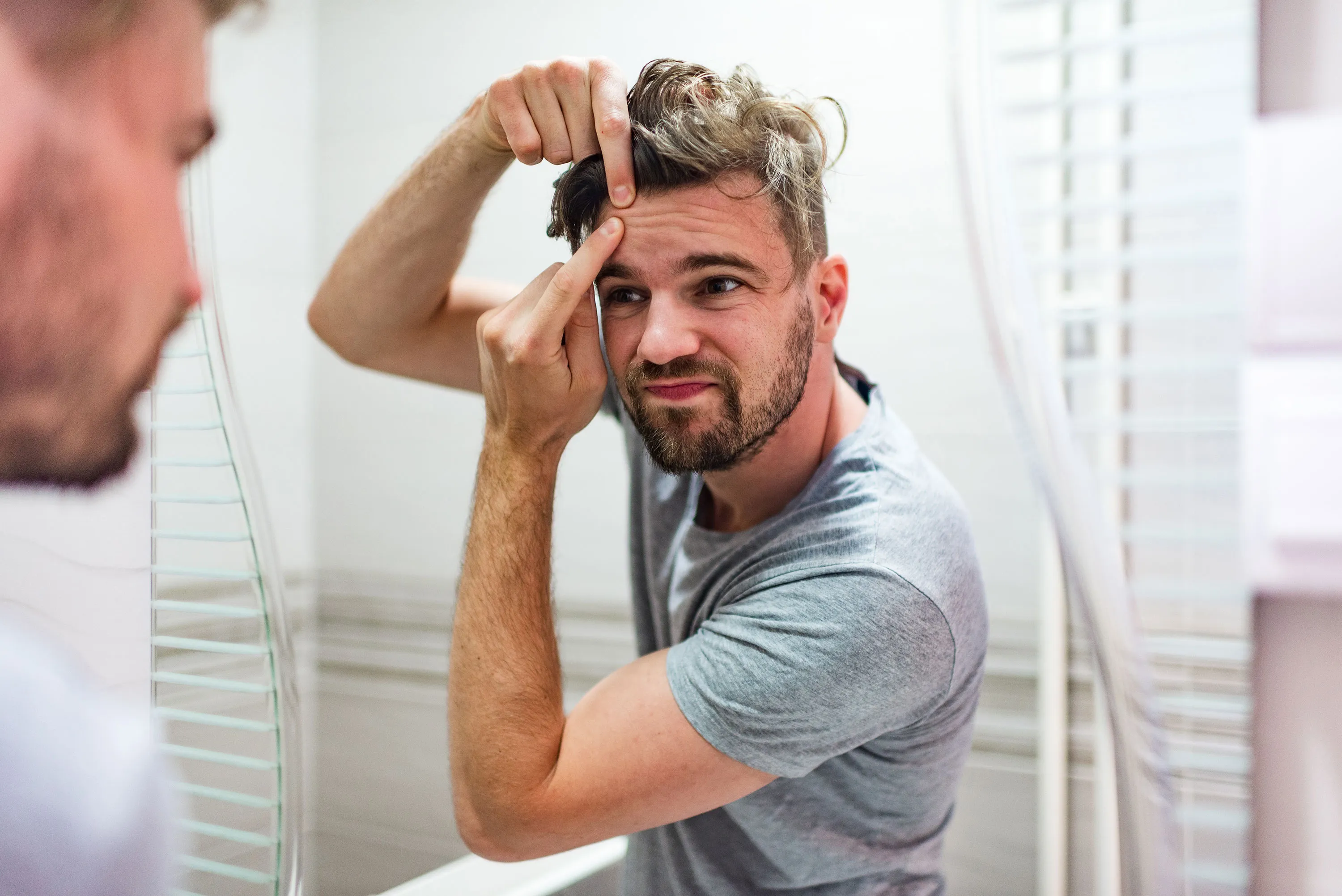 ¿Acné por el calor? ¡Líbrate de él! Te decimos cómo