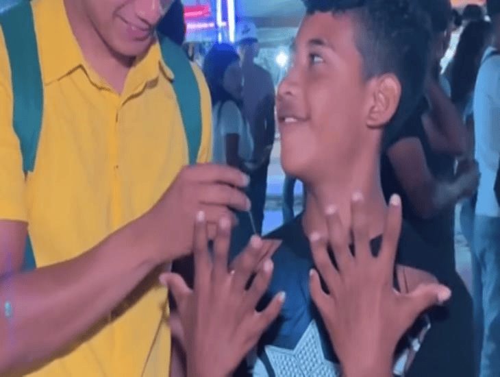 Se hace viral niño con seis dedos en manos y pies de Isla, Veracruz |VIDEO