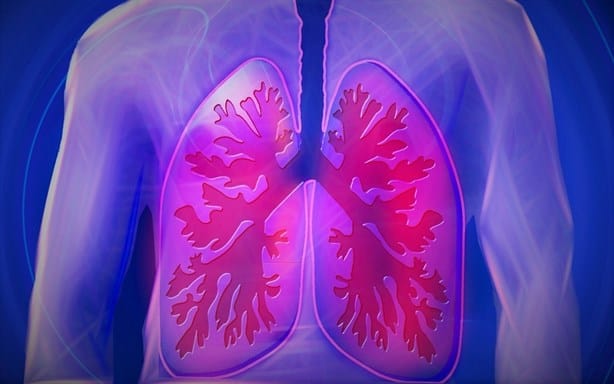 Hipertensión pulmonar, enfermedad que afecta al 10% de adultos mayores del planeta