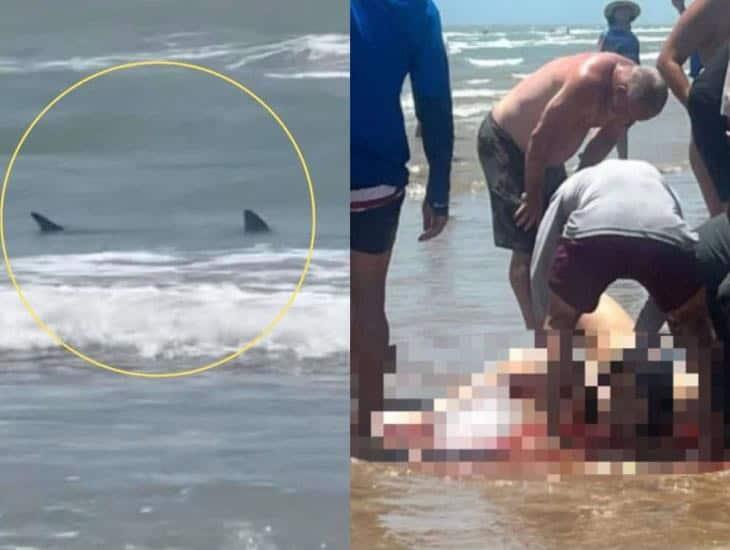 Ataque de tiburones en playas de Texas suman cuatro heridos; sobreviviente cuenta su historia | VIDEO