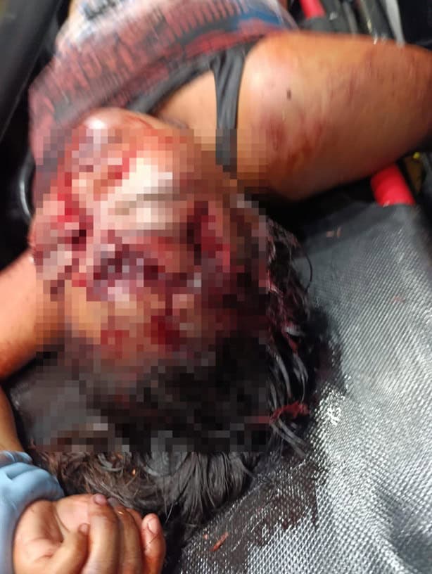 Feminicidio en Acayucan: mujer es brutalmente asesinada por vendedor de raspados
