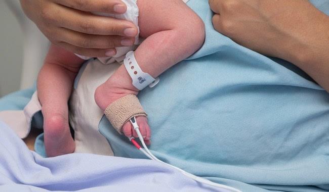 Estas son las enfermedades que más se detectan con el tamiz neonatal