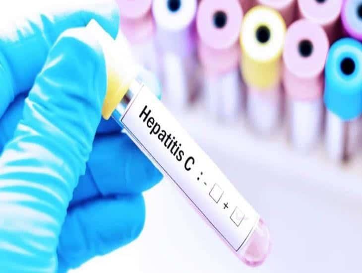 Por esta razón México busca acabar con la hepatitis para el 2030