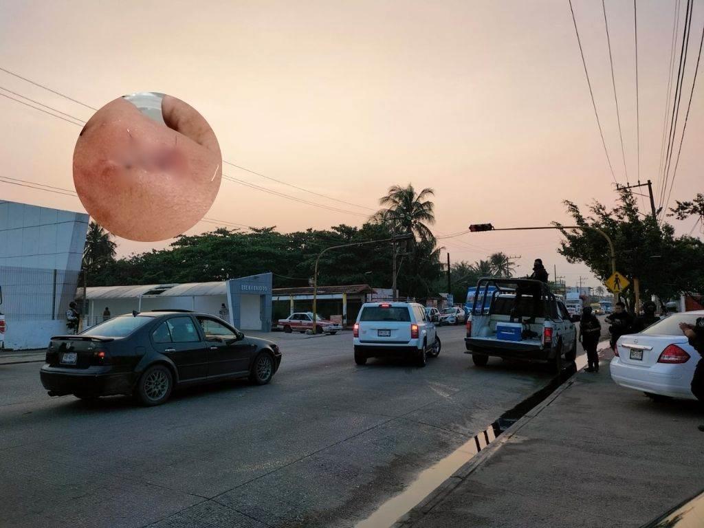 Asaltan y lesionan a masculino frente a la Central de Coatzacoalcos