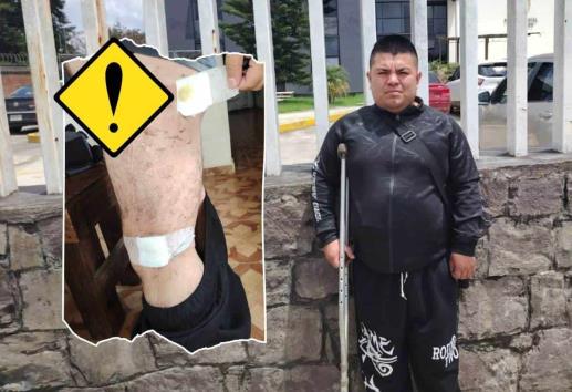 Hace 6 años un accidente incapacitó a Leonardo Rojas; sigue sin recibir indemnización