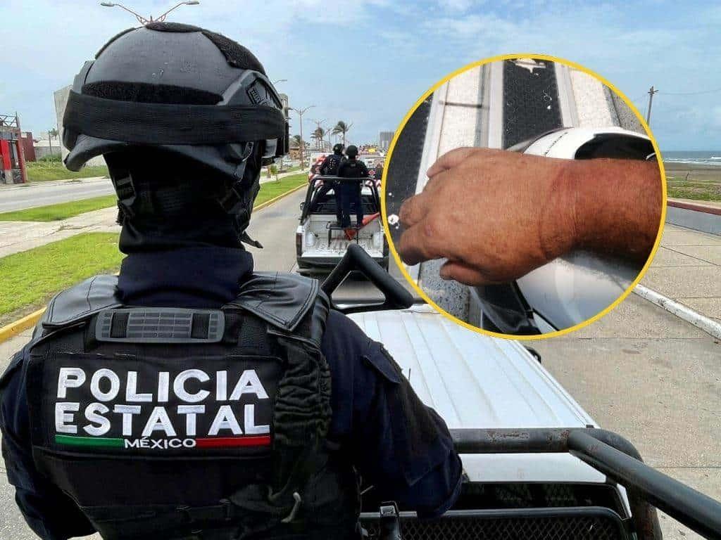 Policías estatales detienen sin explicación y lesionan a reportero de Diario del Istmo en Coatzacoalcos