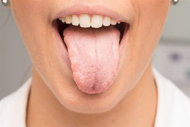 ¿Tienes la lengua blanca?; estas pueden ser las causas ¡así puedes prevenirlo! 