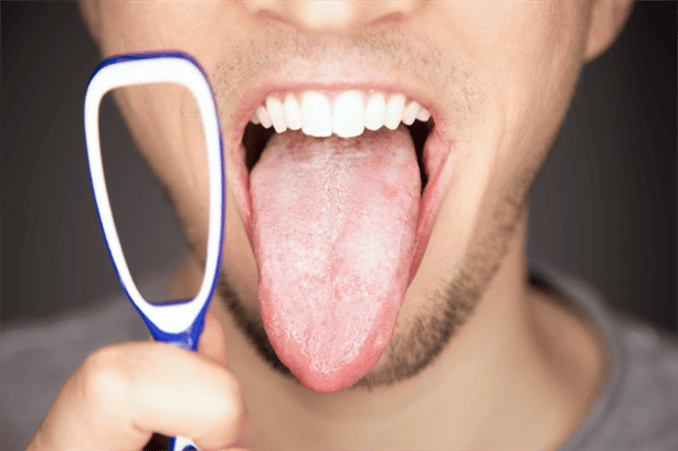 ¿Tienes la lengua blanca?; estas pueden ser las causas ¡así puedes prevenirlo! 