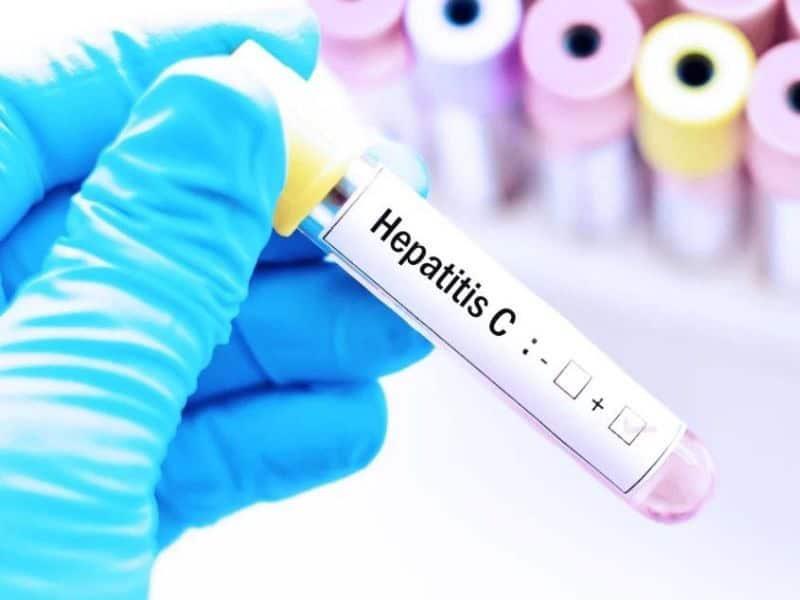 Alertan por aumento de casos de hepatitis C; es tercera causa de muerte en México