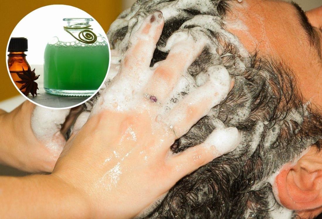 Dermatólogo revela si el shampo provoca caída del cabello | Recomendaciones