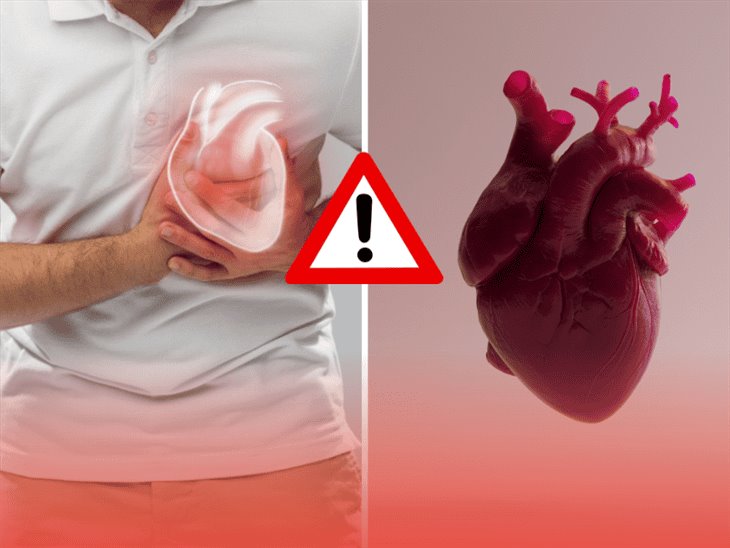 ¡Cuidado! estos son los síntomas de un infarto silencioso, según estudio