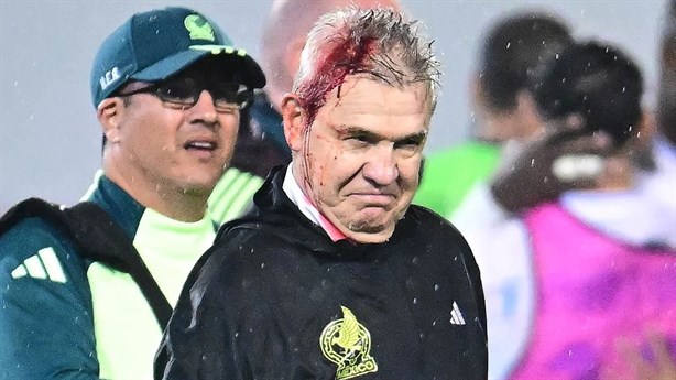 ¿Qué necesita México para remontar en la vuelta frente a Honduras?