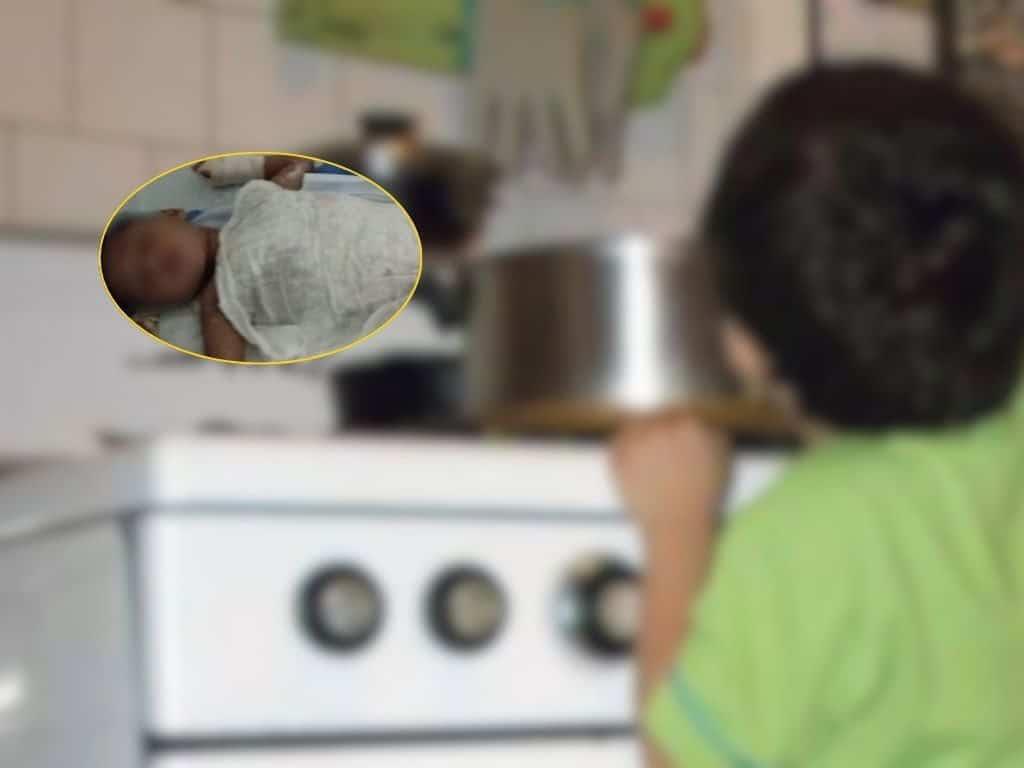 Niño de 2 años sufre quemaduras tras caerle agua hirviendo; solicitan ayuda en Minatitlán