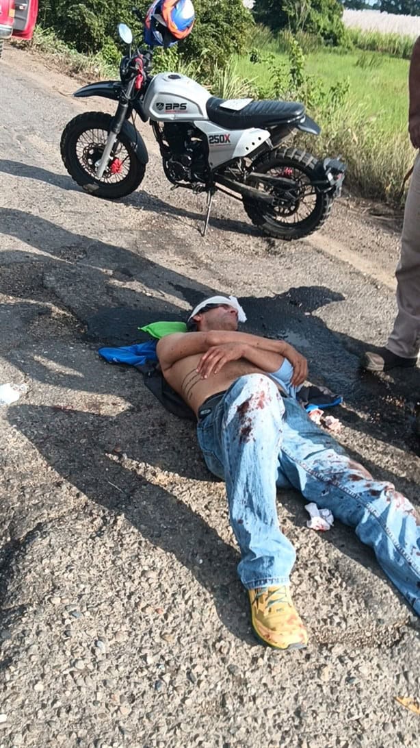 Motociclista sufre grave accidente en carretera de Cosamaloapan