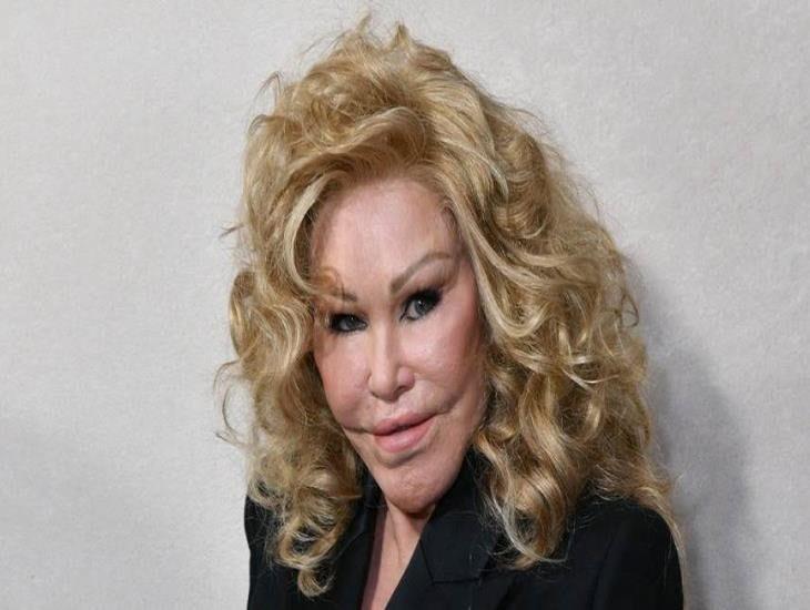 Muere Jocelyn Wildenstein, la multimillonaria conocida como La mujer gato