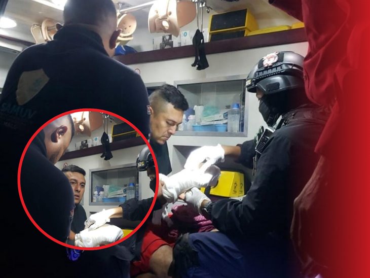 Le explota pirotecnia a hombre en Cosamaloapan; sufre amputación