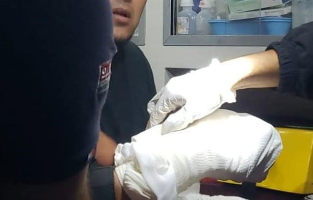 Hombre pierde los dedos tras explosión de pirotecnia en Cosamaloapan
