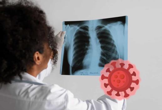 Virus HMPV: personas con secuelas de covid serían más susceptibles