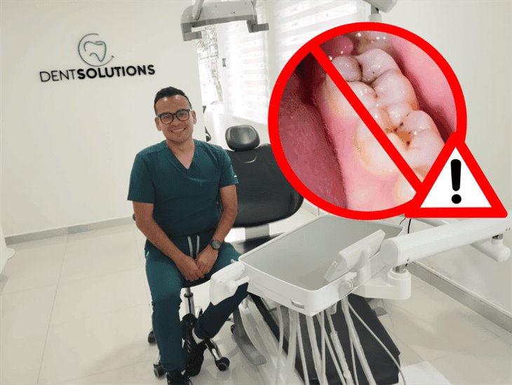 La caries pueden transmitirse a través de los besos; este 14 de febrero toma precauciones (+ VIDEO) 