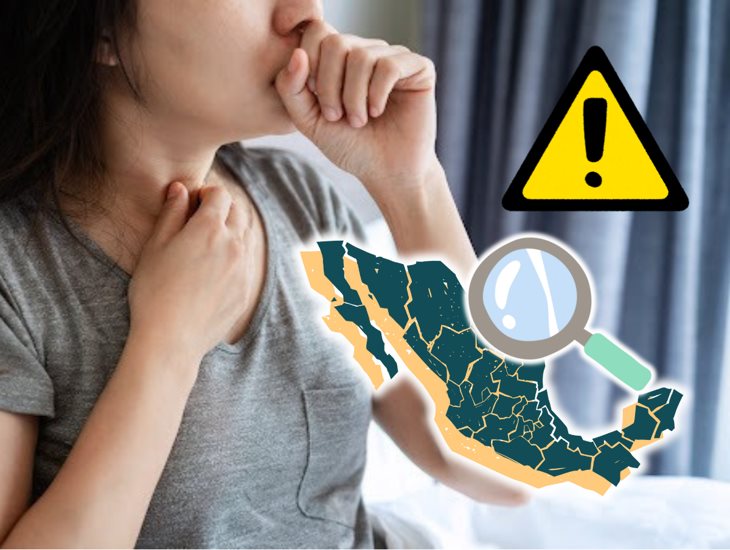 Estos son los estados con más casos de tosferina en México