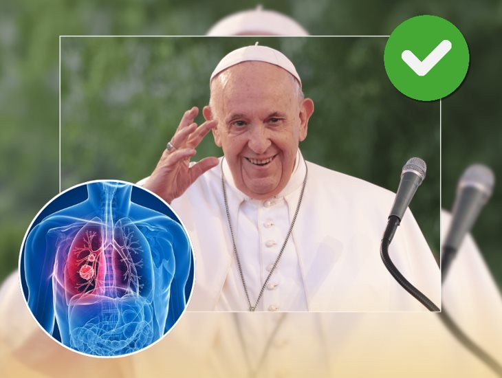 Papa Francisco: este es su estado de salud hoy 12 de marzo ¿hay mejoría?