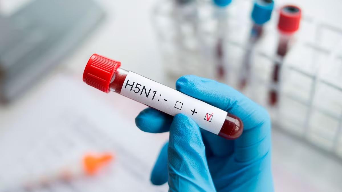 Detectan el primer caso humano de Influenza aviar A en México