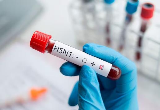 Detectan el primer caso humano de Influenza aviar A en México