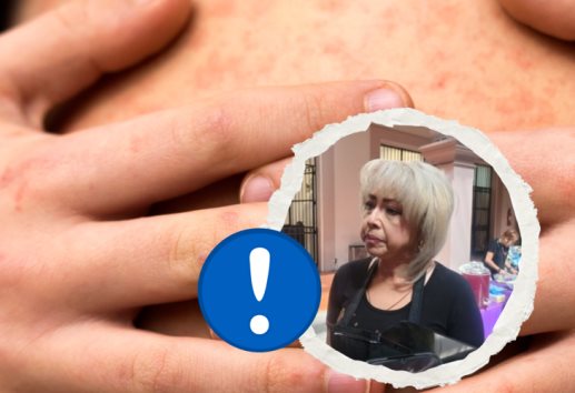En Xalapa, van dos casos de sarampión; exhortan a vacunarse
