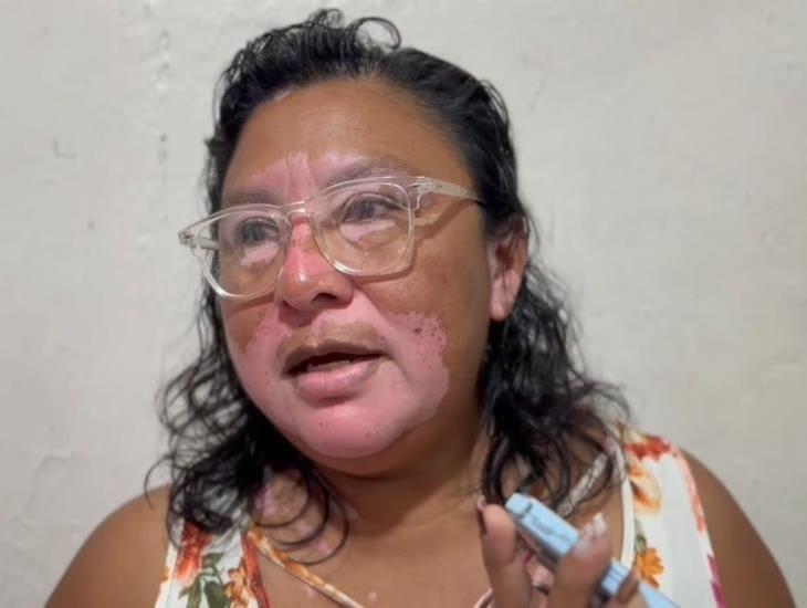 Herminia Pérez, en medio de su pobreza económica, tiene  esperanza de ser edil