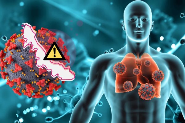 Veracruz suma más de 400 casos de tuberculosis en lo que va de 2025: Salud