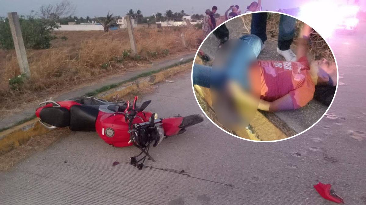 Motociclista terminó con una pierna deformada tras accidente en Coatzacoalcos