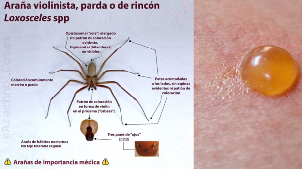 Araña violinista cobra otra víctima: Fernanda falleció en solo 90 minutos