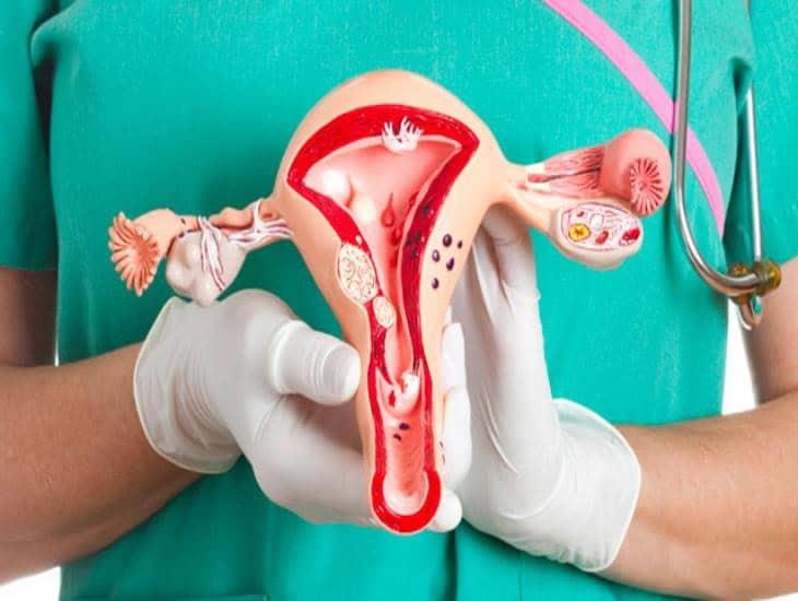 Hoy es el Día Mundial del Cáncer de Ovario, conoce la fecha y datos en México
