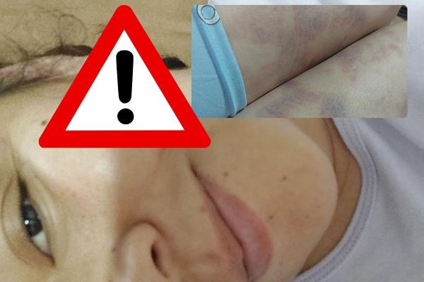 Jueza deja en casa a agresor con antecedentes; víctima teme por su vida