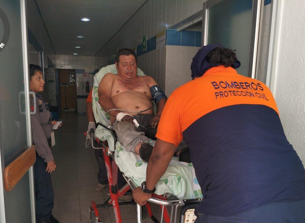 Mecánico sufre graves quemaduras tras explosión en Texistepec