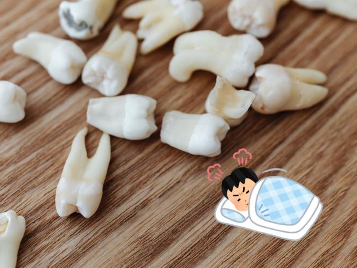 ¿Qué significa soñar que se te caen los dientes?