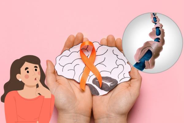 Día Mundial de la esclerosis múltiple; ¿es hereditaria?