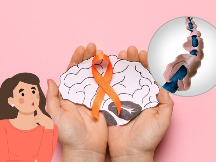 Día Mundial de la esclerosis múltiple; ¿es hereditaria?