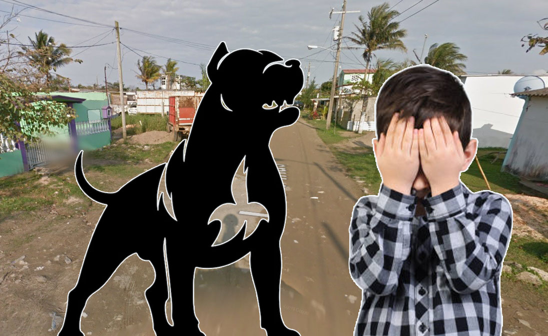 Pitbull ataca a niño; abuela y madre forcejearon con el perro para rescatar al pequeño Damián